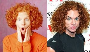 Carrot Top Plastic Surgery Before & After