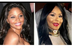 Lil Kim Plastic Surgery Before And After