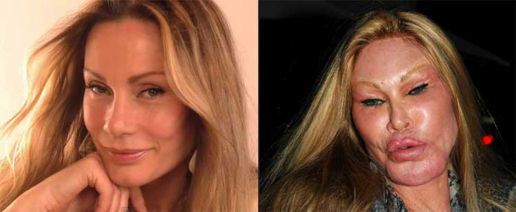 jocelyn-wildenstein-plastic-surgery-before-and-after - Viral Newsman.